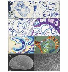 Phymatosorus scolopendria. T&eacute;tradas de esporas, anillo del esporangio y esporas maduras. A. T&eacute;tradas inmaduras rodeadas por el tapete plasmodial (Toluidina). B-F. Desarrollo de las esporas y diferenciaci&oacute;n del anillo del esporangio (Toluidina A-E. y Safranina-azul de alciano-FASGA F.). B-C. T&eacute;tradas de esporas en disposici&oacute;n decusada o tetragonal. El estrato externo del tapete celular persiste. D. Esporas en c&aacute;maras plasmodiales individuales. E. Detalle del perisporio, exosporio y endosporio. G-H. Esporas monoletes maduras con ornamentaci&oacute;n rugada y orb&iacute;culas (Microscop&iacute;a electr&oacute;nica de barrido-MEB). AE: anillo del esporangio; CP: c&aacute;maras plasmodiales; ES: esporas; EN: endosporio; EX: exosporio; OR: orb&iacute;culas; PE: pared del esporangio; PER: perisporio; RM: lesura monolete; TC: estrato externo del tapete celular; TI: t&eacute;trada inmadura; TP: tapete plasmodial.