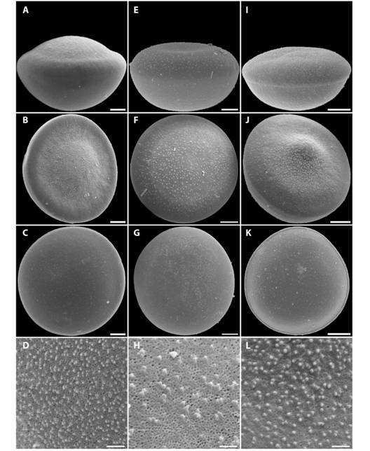 (A, B, C, D) Vag-18; (E, F, G, H) Adf-03 y (I, J, K, L) Spi-15. A, E, I) en vista ecuatorial; (B, F, J) cara distal; C, G, K) cara proximal y (D, H, L) ornamentaci&oacute;n de la exina. (A, B, C, E, F, G, I, J, K) Esc = 10 &micro;m; (D, H, L) Esc = 2 &micro;m.