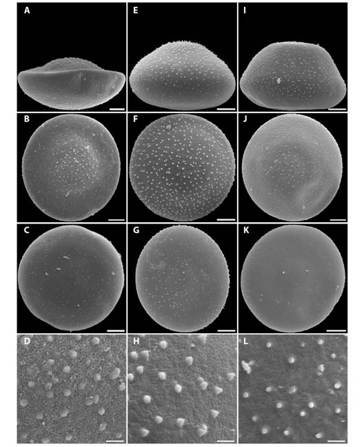 (A, B, C, D) Lib-13; (E, F, G, H) Bou-08 y (I, J, K, L) Cha-07. (A, E, I) vista ecuatorial; (B, F, J) cara distal; (C, G, K) cara proximal y (D, H, L) ornamentaci&oacute;n de la exina. (A, B, C) Esc = 8 &micro;m; (E, F, G, I, J, K) Esc = 10 &micro;m y (D, H, L) Esc = 2 &micro;m.