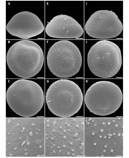 (A, B, C, D) Uxp-10; (E, F, G, H) Uxp-12 y (I, J, K, L) Uxp-11. A, E, I) vista ecuatorial; (B, F, J) cara distal; (C, G, K) cara proximal y (D, H, L) ornamentaci&oacute;n de la exina. (A, B, C, E, F, G, I, J, K) Esc =10 &micro;m y (D, H, L) Esc = 2 &micro;m.