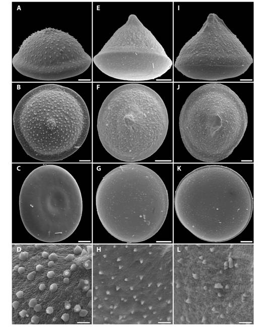 (A, B, C, D) Lat-04; (E, F, G, H) Col-01 y (I, J, K, L) Col-27. (A, E, I) vista ecuatorial; (B, F, J) cara distal; (C, G, K) cara proximal y (D, H, L) ornamentaci&oacute;n de la exina. (A, B, C, E, F, G) Esc = 8 &micro;m, (I, J, K) Esc = 10 &micro;m, (D, H, L) Esc = 2 &micro;m.