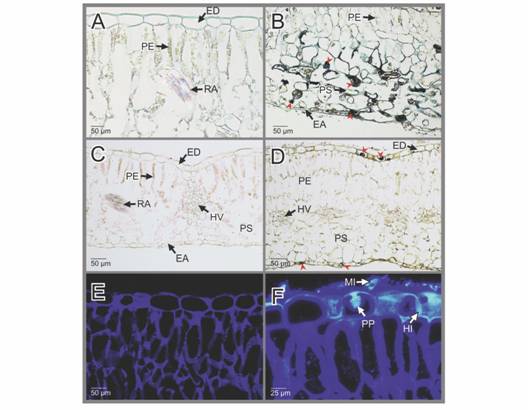 EA: epidermis abaxial; ED: epidermis adaxial; HV: haces vasculares; MI: micelio; PE: par&eacute;nquima de empalizada; PP: papilas; PS: par&eacute;nquima esponjoso; RA: rafidios. Hydrangea macrophylla. Pruebas histoqu&iacute;micas aplicadas a las secciones de hojas sanas e infectadas por la Oidiosis o ceniza. A-B. Secciones transversales de hojas sanas e infectadas respectivamente te&ntilde;idas con negro de Sudan. En B, Los agregados de color negro indicar&iacute;an la presencia de l&iacute;pidos (cabezas de flecha roja). C-D. Secciones transversales de hojas sanas e infectadas respectivamente, te&ntilde;idas con Cloruro f&eacute;rrico. En D, los agregados negros, indicar&iacute;an la presencia de presencia de polifenoles (cabezas de flecha roja). E-F. Secciones transversales de hojas sanas e infectadas te&ntilde;idas respectivamente con Uvitex 2B-Hematoxilina (microscop&iacute;a de fluorescencia).