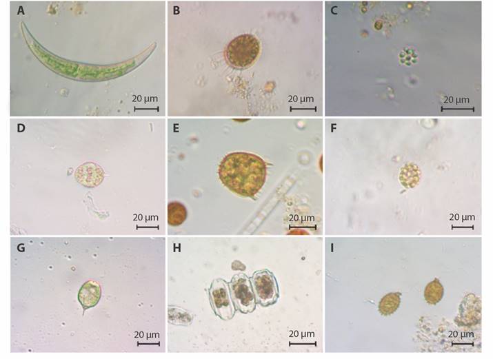 Phytoplankton species of the nine tropical lakes from the Northeast Colombian Andes. a. Closterium venus, b. Trachelomonas armata var. armata, c. Coelastrum microporum, d. Lepocinclis ovum, e. Trachelomonas armata var. litoralensis, f. Eudorina elegans, g. Phacus suecicus, h. Desmidium sp3, i. Trachelomonas similis var. spinosa.