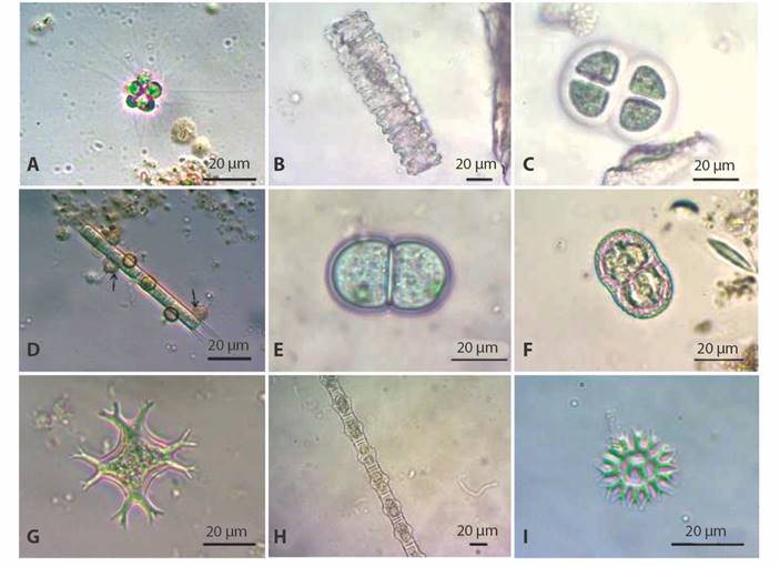 Phytoplankton species of the nine tropical lakes from the Northeast Colombian Andes. a. Micractinium pusillum, b. Desmidium swartzii, c. Chroococcus turgidus, d. Lagynion sp1, e. Cyanothece aeruginosa, f. Actinotaenium cucurbita, g. Isthmochloron lobulatum, h. Bambusina brebissonii, i. Parapediastrum biradiatum.