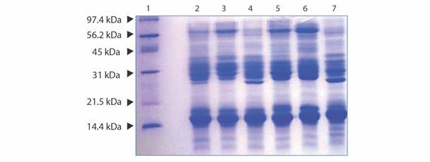 Electrophoretic patterns obtained by SDS PAGE (15 % acrylamide) run under reducing conditions using 15μg of Panamanian B. asper reference venom, Costa Rican venom and venom from each Panamanian zone. Lane 1: Low Range Molecular Weight Marker (Bio-Rad); Lane 2: Reference B. asper venom from Panama; Lane 3: B. asper venom from Costa Rica; Lane 4: B. asper venom from Panama Zone 1 (Atlantic); Lane 5: B. asper venom from Panama Zone 2 (Chiriqu&iacute; and Pacific Veraguas); Lane 6: B. asper venom from Panama Zone 3 (Los Santos, Herrera and Cocle); Lane 7: B. asper venom from Panama Zone 4 (Panama and Dari&eacute;n). Gels were stained with Coomassie Brilliant Blue.