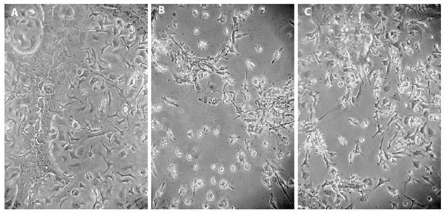 Morphological analysis of primary mixed glial cells under phase contrast microscopy after 48h of incubation with alkaloid enriched extracts. A. Control (x 200 magnification). B.P. flexuosa (30 μg/mL - x200). C.P. nigra (30 μg/mL-x 200 magnification).