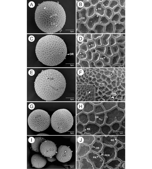 Granos de polen y detalles micromorfol&oacute;gicos de los genotipos de Theobroma cacao. Se observan los colpos y las orb&iacute;culas sobre la superficie del ret&iacute;culo. A, B.Theobroma Corpoica La Suiza TCS 19. En A. (vista ecuatorial) la cabeza de flecha indica dos orb&iacute;culas fusionadas. C, D. Selecci&oacute;n Colombia Corpoica SCC 19. E, F. Selecci&oacute;n Colombia Corpoica SCC 61. E. vista ecuatorial. La cabeza de flecha en F. muestra dos orb&iacute;culas fusionadas y el detalle indica orb&iacute;culas con microgranulaciones (flecha). G, H. Colecci&oacute;n Castro-Naranjal CCN 51. G. a la izquierda, orb&iacute;cula sobre el polo; a la derecha se observa en vista ecuatorial el colpo. I, J. Scavina SCA 6. CO: colpo; OR: orb&iacute;culas; RE: ret&iacute;culo; PER: perforaciones; PK: pollenkit. Fig. 3. Pollen grains and micromorphological details of Theobroma cacao genotypes. Colpi and orbicules are observed on the surface of the reticulum. A, B.Theobroma Corpoica La Suiza TCS 19. In A. (equatorial view) arrowhead indicates two fused orbicules. C, D. Selecci&oacute;n Colombia Corpoica SCC 19. E, F. Selecci&oacute;n Colombia Corpoica SCC 61. E. equatorial view. The arrowhead in F. shows two fused orbicules and the detail indicates orbicules with microgranulations (arrow). G, H. Colecci&oacute;n Castro-Naranjal CCN 51. G. on the left, orbicule on the pole; on the right colpus in the equatorial view I, J. Scavina SCA 6. CO: colpus; OR: orbicules; RE: reticulum; PER: perforations; PK: pollenkitt.