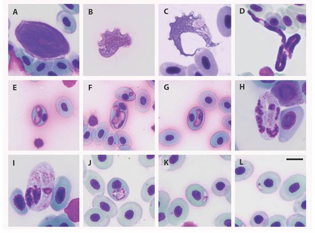 Blood parasites infecting Colombian amphibians analyzed in the study A-C.Trypanosoma; D. Microfilaria; E-G.Hepatozoon-like; H-I.Karyolysus-like; J-L.Dactylosoma. Giemsa stain. Scale bar: 10 μm; Differences in the sizes of RBCs are due to their belonging to different host species.