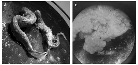 Contenido estomacal familia Achiridae. A. Peces. B. Huevos, ingeridos por las especies A. mazatlanus y A. klunzingeri.Fig. 2. Stomach content family Achiridae. A. Fish, B. Eggs, ingested by the species A. mazatlanus and A. klunzingeri.