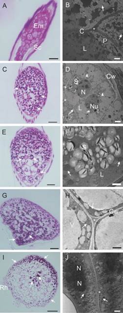 Reserve compounds during germination and post-seminal development in vitro of Cattleya crispa seeds.A.-B. 0 DAS. A. starch granules did not appear with PAS staining. B. Embryo rich in lipid and protein bodies. Arrows indicate a few early starch granules that did not appear with PAS staining. C.-D. 7 DAS. C. Germination. Deposition of polysaccharides (arrow). D. Arrow: cell walls were still thin; arrowheads largely digested protein bodies. E.-F. 15 DAS. E. The polysaccharides tend to congregate around the nucleus (arrow). F. Presence of glyoxysomes, found in proximity to the lipid bodies in process of digestion (arrow). G.-H. 30 DAS. G. Increased polysaccharides in the basal region of the protocorm (arrow). H. Parenchyma cells largely vacuolated with disorganized protein (arrow). I.-J. 60 DAS. I. Polysaccharides mobilized to the cells of the shoot apex in differentiation and to the cell layers close to the epidermis (arrow). J. Cells with extensive lipidic bodies formation (arrow). Em embryo; Sc seed coat; Cw Cell wall; L lipid bodie; P protein bodies; S starch grain; N nucleus; Nu nucleolus; Rh rhizoids; * Middle lamella. Bar: 50 &micro;m (A., E.). 100 &micro;m (C., G., I.). 2 &micro;m (B., D., J.). 1 &micro;m (F., H.).