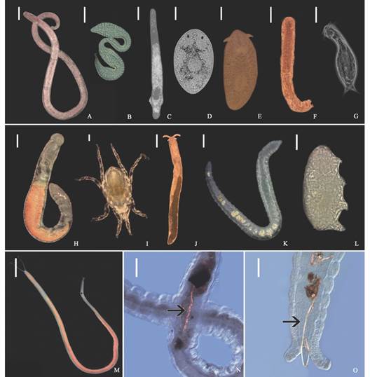 Meiofauna diversity shown by examples from a variety of higher taxa. A. Nematoda, Enoplida; B. Nematoda, Epsilonematidae; C. Platyhelminthes, Proseriata; D. Platyhelminthes, Dalyelliidae; E. Platyhelminthes, Polycladida; F. Gastrotricha, Macrodasyidae; G. Gastrotricha, Chaetonotida; H. Annelida, Sedentaria,Ctenodrilussp.; I. Arthropoda, Chelicerata, Acari; J. Mollusca, Gastropoda,Microhedylesp; K. Annelida, Clitellata, Olygochaeta, L. Tardigrada, Heterotardigrada, Echiniscoididae; M. Annelida, Sedentaria, Saccocirrus cf. pussicus; N.-O.Saccocirrus cf. pussicus collected from the Santa Marta region that exhibit microfibers inside their gut. Scales in A., E., H., J., K., M. 200 &micro;m; in C., D., N., O. 100 &micro;m; and in B., F., G., I., L., 50 &micro;m.
