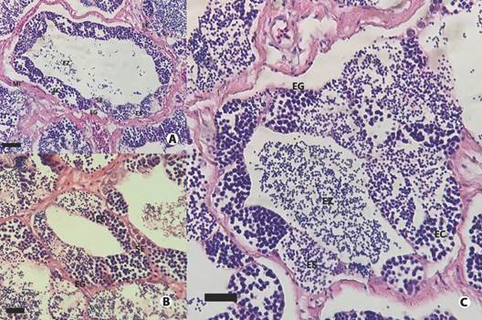 Test&iacute;culo lobular irrescricto de Plagioscion magdalenae.A. Test&iacute;culo en estado de maduraci&oacute;n tard&iacute;a, se observan espermatogonias (EG), espermatocitos (EC) y esperm&aacute;tidas (ES) en cistos prontas a liberaci&oacute;n, pocos espermatozoides (EZ) en el lumen. Adem&aacute;s se observan c&eacute;lulas de Sertolli (SE) en el tejido germinal, c&eacute;lulas de Leydig (LE) y vasos sangu&iacute;neos (VS) en el tejido interticial y c&eacute;lulas mioides (MI) en la membrana basal. B. L&oacute;bulo semin&iacute;fero en inicio de maduraci&oacute;n, se observan espermatogonias y espermatocitos acompa&ntilde;ados de c&eacute;lulas de Sertoli. C. Se observan todas las fases de la espermatog&eacute;nesis: espermatogonias, espermatocitos, esperm&aacute;tidas y espermatozoides. Escala: A. 30 &micro;m, B. 30 &micro;m, C. 20 &micro;m. / Fig. 9. Unrestricted lobular testis of Plagioscion magdalenae. A. Late maturing testis, spermatogonia (SG), spermatocytes (EC) and spermatids (ES) in cysts close to be released, few spermatozoa (EZ) in the lumen. In addition, Sertolli cells (SE) are observed in the germinal compartment, Leydig cells (LE) and blood vessels (VS) in the interstitial compartment and myoid cells (MI) in the basement membrane. B. Seminiferous lobule at the beginning of maturation, spermatogonia and spermatocytes accompanied by Sertoli cells are observed. C. All phases of spermatogenesis are observed: spermatogonia, spermatocytes, spermatids, and spermatozoa. Scale: A. 30 &micro;m, B. 30 &micro;m, C. 20 &micro;m.