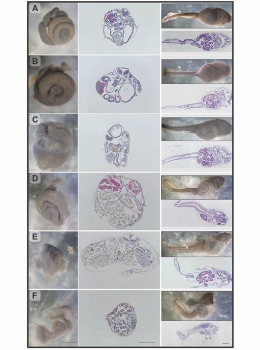 Rhinella arenarum larvae, observation under stereoscopic microscope and longitudinal and transverse histological sections. A. Grade 0, normal larva. B. Grade 1, mild abdominal bloating. C.-D. Grade 2/3, moderate abdominal bloating, respectively. E. Grade 4, severe abdominal bloating. F. Grade 5, severe abdominal bloating, and compact intestine. H&E and Masson's trichrome techniques. Scale bar: 500 µm.
