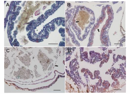Histology of the intestinal wall in larvae of Rhinella arenarum. A. Normal intestine. B. Bowel with grade 2 abnormality, there is intense bleeding (arrows) in the digestive tract. C. Bowel with grade 3/4 abnormality, note thinning of the bowel wall (arrow). D. Bowel with grade 5 abnormality, digestive tract wall rupture, loss of tissue architecture, cell peeling, and bleeding. Masson's trichrome technique. Scale bar: 50 µm.