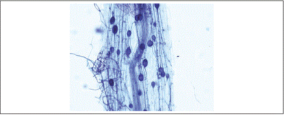 Ra&iacute;z de planta de mora ecotipo monterrico colonizada por Glomus  sp. (GEV02) en el tratamiento coinocualdo con Pseudomonas migulae  (Pf014). Imagen tomada al microscopio &oacute;ptico (40x).