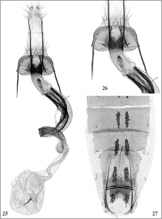 C. aragonensis Tabell, sp. n.: 25. Female genitalia, paratype (GP 4676 J. Tabell), Spain, Teruel). 26. Sterigma enlarged (Photos: Reijo Siloaho). 27. Abdomen (Photo: Pasi Sihvonen).