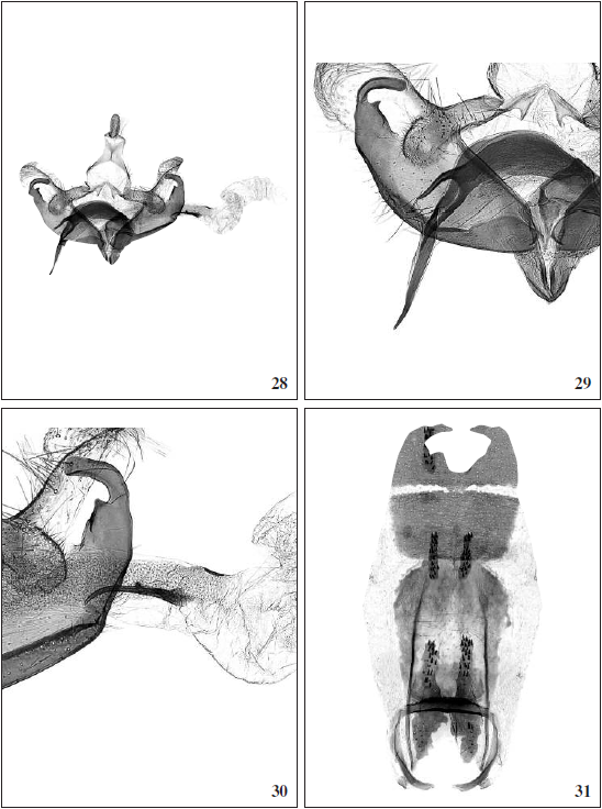 C. forcipata Tabell, sp. n.: 28. Male genitalia, holotype (GP 4681 J. Tabell), Spain, Teruel. 29. Cucullus and sacculus enlarged. 30. Cornuti enlarged. 31. Abdomen (Photos: Reijo Siloaho).