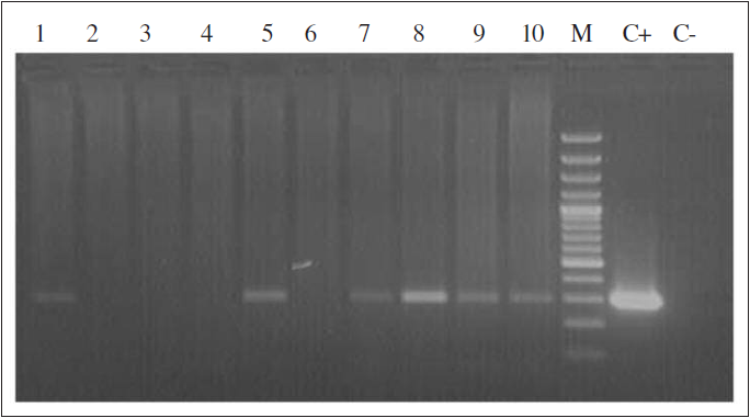 PCR detection of virus LD 130 gene in embryos of the Trans-Ural gypsy moth population (2011). 1, 5, 7-10-positive at virus; 2-4, 6-negative at virus; M-ladder O’GeneRuler 100bp Plus DNA Ladder (FERMENTAS, USA); C+ - positive control, Ñ- - negative control.