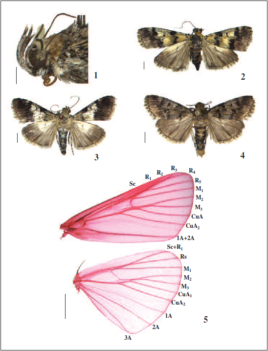 Adults and venation of Epilepia spp. 1. Head of E. denticulata Rong & Li, sp. n., male; 2. E. denticulata Rong & Li, sp. n., paratype, female; 3. E. longaduncata Rong & Li, sp. n., holotype, male; 4. E. dentatum (Matsumura & Shibuya), male. 5. Venation of E. dentatum (Matsumura & Shibuya). Slide No. RH16039W. Scale bars: 1=1.0 mm, 2–5=2.0 mm.