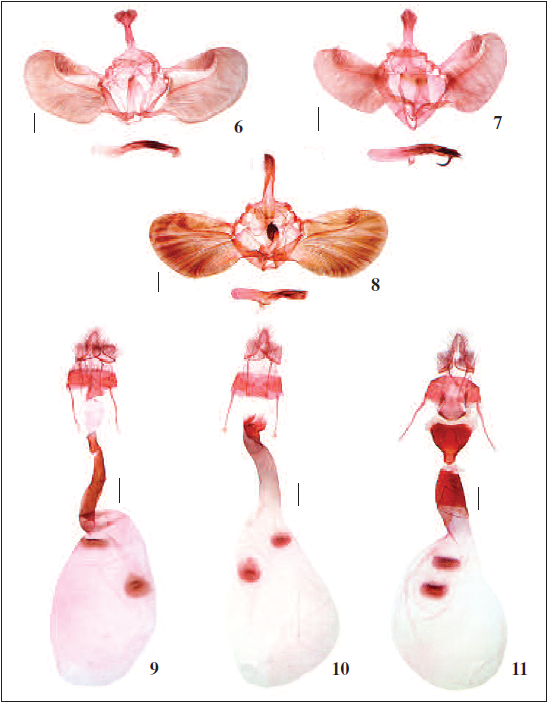 Male genitalia of Epilepia spp. 6. E. denticulata Rong & Li, sp. n., paratype, slide No. RH15533; 7. E. longaduncata Rong & Li, sp. n., paratype, slide No. RH16045; 8. E. dentatum (Matsumura & Shibuya), slide No. RH15447. Scale bars: 0.5 mm. 9-11.– Female genitalia of Epilepia spp. 9. E. denticulata Rong & Li, sp. n., paratype, slide No. RH15362; 10. E. longaduncata Rong & Li, sp. n., paratype, slide No. RH16046; 11. E. dentatum (Matsumura & Shibuya), slide No. RH15446. Scale bars: 0.5 mm.