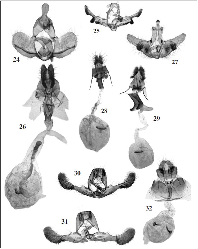Genitalia. 24.Procrica parisii Razowski & Trematerra, Suba Forest, Ethiopia; 25. Lobesia semosa Diakonoff, Ambo Park, Ethiopia; 26. Bactra stagnicolana Zeller, Ambo Park, Ethiopia; 27.Parabactra addisalema Razowski & Trematerra, sp. n., holotype; 28. Emrahia tenuivalva Razowski & Trematerra, Zegie Peninsula, Ethiopia; 29. Endothenia ethiopica Razowski & Trematerra, Zegie Peninsula, Ethiopia; 30.Megaherpystis subae Razowski & Trematerra, sp. n., holotype; 31-32. Megaherpystis oromiae Razowski & Trematerra, sp. n., holotype and paratype, male and female.