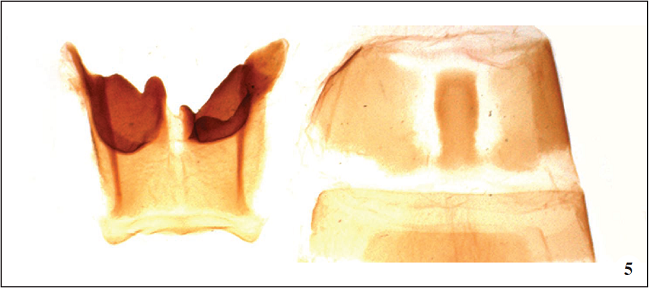 Paratype ♂, 8th abdominal segment: left sternite, right tergite.