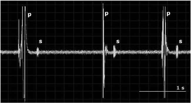 Sonograma del sonido emitido por una pupa de Zizeeria knysna. Se observan las perturbaciones ejercidas sobre la pupa que tienen una mayor intensidad (p) y las respuestas emitidas por la misma con forma de sílabas simples y posteriores al estímulo (s).