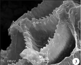 Borde dentado de las paredes intercelulares del huevo de L. albicans.