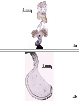 Abb 4.