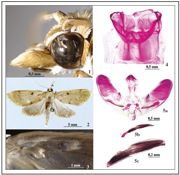 Crypsiptya spinosa Jie & Li, sp. n.: 1. Head on lateral view, paratype; 2. Adult, holotype; 3. Basal detail of forewing on ventral side, holotype; 4. Tympanal organs, holotype (slide no. JL17256); 5. Male genitalia, holotype (slide no. JL17256)