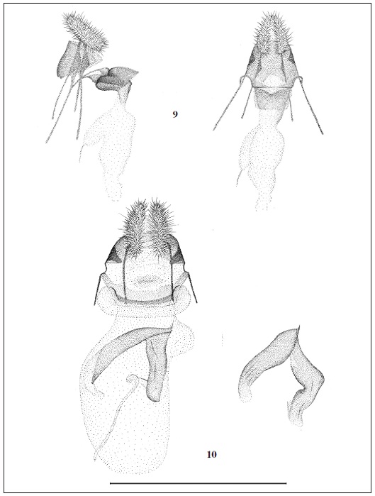Female genitalia of Phtheochroa sp. (scale 1 mm). 9. Phtheochroa accurata Tsvetkov, sp. n.; 10. Phtheochroa suleimana Tsvetkov, sp. n., variation of sclerite on the right image.