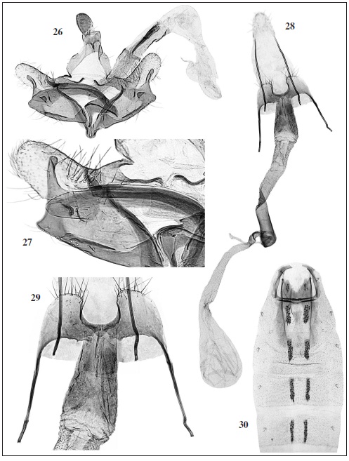 C. intexta Meyrick. 26. Male genitalia (GP Bldz 9796) “PERU: Dept. Lima | 2: 8 km E Chosica | San Bartolomé | 1900 m | 20-23-I-1987 | O. Karsholt leg.”. 27. Detail of cucullus, sacculus, phallotheca. 28. Female genitalia (GP Bldz 9800) “PERU: Dep. Ancash | 25: 15 km N Caras | Rio Salta Valley | ca. 2000 m | 19­21-II-1987 | O. Karsholt leg.”. 29. Detail of sterigma, ostium bursae, colliculum. 30. Abdomen.
