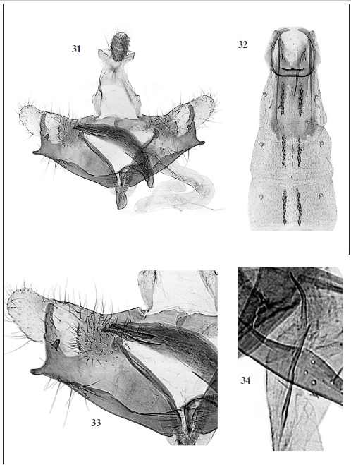 C. andina Baldizzone, sp. n. 31. Male genitalia (GP Bldz 9793, holotype). 32. Abdomen. 33. Detail of cucullus, sacculus, phallotheca. 34. Detail of cornuti.