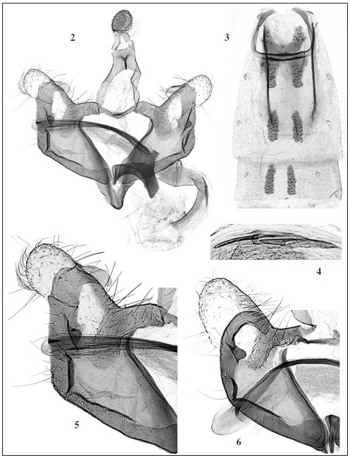 Coleophora spp., male genitalia. 2. C. antiqua Baldizzone, sp. n., GP Bldz 16936, holotype. 3. Abdomen. 4. Enlargement of cornuti. 5. Enlargement of transtilla, cucullus, sacculus and apical part of phallotheca. 6.C. scabrida Toll, same enlargement, GP Bldz 16618, Croatia, Island Krk, Punat, loc. Hrusta, 230 m, 29-V-2018, leg., coll. Bldz.