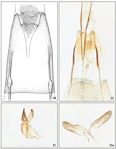 Rhodobates carsteni Falck, Gaedike & Vives, sp. n., ♀, Lanzarote, GP9765RG. 11. Tinea laurisilvaella Falck, Gaedike & Vives, sp. n., ♂, Gran Canaria, uncus-tegumen complex, GP3046PF. 11a. Valva-saccus complex and phallus, GP3046PF. 12. Tinea laurisilvaella Falck, Gaedike & Vives, sp. n., ♀, Gran Canaria, GP2978PF.