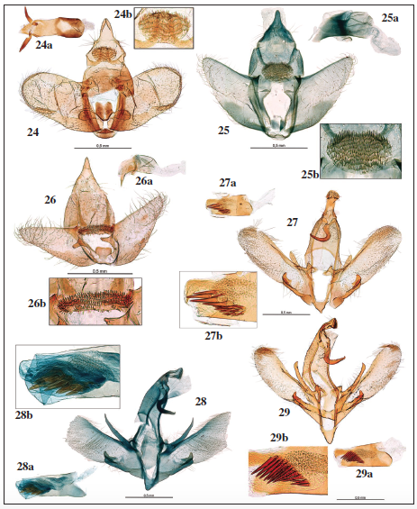Genitalia macho: 24. Agnoea (Agnoea) revillai Gastn & Vives, sp. n., holotypus, prep. gen. 7977JG. 24a. Idem, aedeagus. 24b. Idem, detalles del gnathos. 25. Agnoea (Agnoea) xanthosoma (Rebel, 1901), prep. gen. 57285AV. 25a. Idem, aedeagus. 25b. Idem, detalle del gnathos. 26. Agnoea (Agnoea) detrimentella (Staudinger, 1859), prep. gen. 57023AV. 26a. Idem, aedeagus. 26b. Idem, detalle del Gnathos. 27. Symmoca requenai Gastn & Vives, sp. n., holotypus, prep. gen. 8004JG. 27a. Idem, aedeagus. 27b. Idem, detalle del mismo. 28. Symmoca tofosella Rebel, 1893, lectotypus, prep. gen. 54611RA (remontada por A. Vives en 1985). 28a. Idem, aedeagus. 28b. Idem, detalle del mismo. 29. Symmoca tofosella Rebel, 1893, prep. gen. 7013JG. 29a. Idem, aedeagus. 29b. Idem, detalle del mismo.
