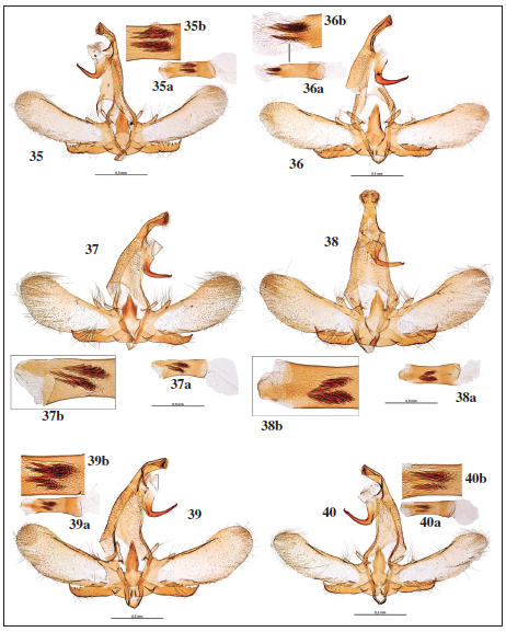 Genitalia macho: 35. Symmoca senora Gozmny, 1977, ♀, prep. gen. 7022JG. 35a. Idem, aedeagus. 35b. Idem, detalle del mismo. 36. Symmoca senora Gozmny, 1977, prep. gen. 6997JG. 36a. Idem, aedeagus. 36b. Idem, detalle del mismo. 37. Symmoca redondoi Gastn & Vives, sp. n., holotypus, prep. gen. 8097JG. 38. Symmoca redondoi Gastn & Vives, sp. n., paratypus, prep. gen. 8095JG. 38a. Idem, aedeagus. 38b. Idem, detalle del mismo. 39. Symmoca dodecatella Staudinger, 1859, prep. gen. 6995JG. 39a. Idem, aedeagus. 39b. Idem, detalle del mismo. 40. Symmoca dodecatella Staudinger, 1859, prep. gen. 7031JG. 40a. Idem, aedeagus. 40b. Idem, detalle del mismo.