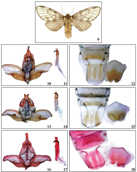 Eustema argentata Becker, sp. n., ♀ Holotype, Brazil. 10-18. Genitalia (ventral view), and 8th abdominal segment of Eustema species: 10-12. E. dara: 10. ♂ genitalia, Nicaragua. 11. aedeagus, lateral view, Nicaragua. 12. 8th abdominal segment (left, tergite; right, sternite). 13-15. E. opaca: 13. ♂ genitalia. 14. aedeagus, lateral view; 15. 8th abdominal segment (left, sternite; right tergite). 16-18. E. dara 16. ♂ genitalia, Brazil. 17. aedeagus, lateral view, Brazil. 18. 8th abdominal segment (left, tergite; right, sternite).