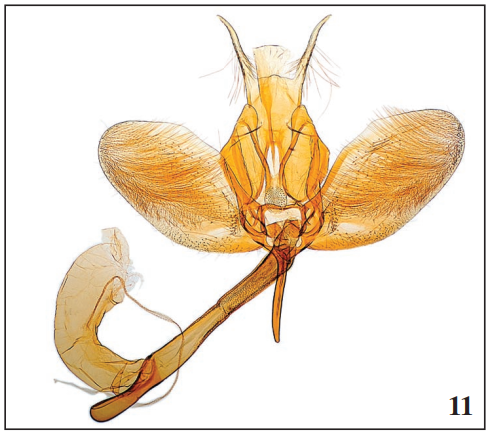 Male genitalia Ypsolopha instabilella (Mann).