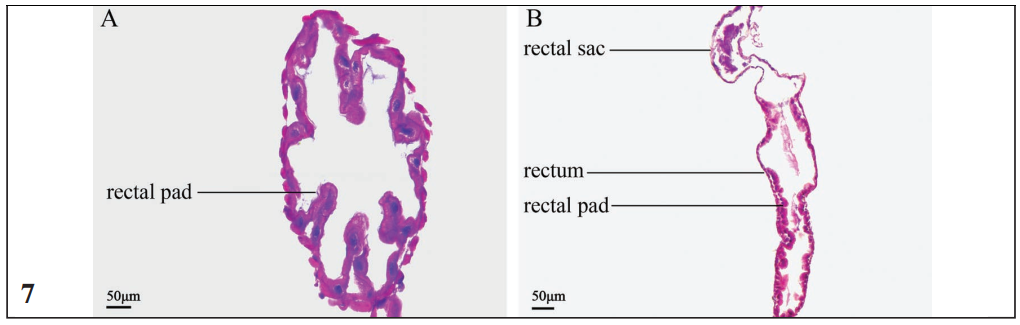 Histological sections of the hindgut.