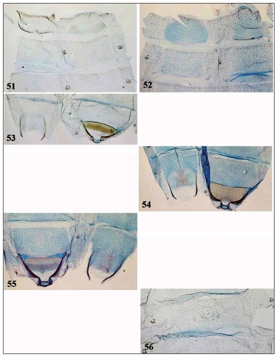 Holcophora spp., abdominal segments. 51.H.statices, Ukraine, male, segments VI-VIII (gen.slide 26/21OB). 52.H. rostrella sp. n., Turkmenistan, male, segments VII-VIII (gen. slide 30/21OB). 53. H.statices, Ukraine, female, segments I-II (gen. slide 27/21OB). 54. H. rostrella sp. n., Turkmenistan, male,segments I-II (gen. slide 30/21OB). 55. H. obtusipalpis, Tunisia, male, segments I-II (gen. slide 29/21OB). 56.H. statices, Ukraine, female tergum V with group of hairs in middle (gen. slide 27/21OB).