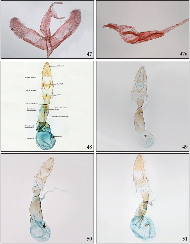 47. Apatema mediopallidumWalsingham, 1900, ♂, Holotype, Corsica, France, no. 13944. Copyright Trustes of the NHMUK. 47a. Phallus, Corsica, France, no. 13944. 48. Schematic illustration of female Apatema genitalia. 49.Apatemaconfluellum Falck & Karsholt, sp. n., ♀, Tenerife, GP2794PF. 50. Apatemaminimum Falck & Karsholt, sp. n., ♀, Lanzarote, GP3196PF. 51.Apatemalapalmae Falck & Karsholt, sp. n., ♀, La Palma, GP3204PF.