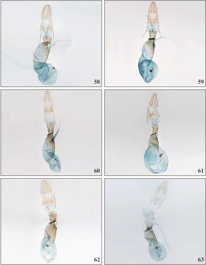 58. Apatema lucidumWalsingham, 1908, ♀, Tenerife, GP3181PF. 59.Apatemagrancanariae Falck & Karsholt, sp. n., ♀, Gran Canaria, GP3198PF. 60.Apatemabrunneum Falck & Karsholt, sp. n., ♀, Tenerife, GP3177PF. 61.Apatema transversum Falck & Karsholt, sp. n., ♀, Gran Canaria, GP2800PF. 62.Apatema stadeli Falck & Karsholt, sp. n., ♀, Tenerife, GP3356aPF. 63.Apatema skulei Falck & Karsholt, sp. n.,♀, Gran Canaria, GP3205aPF.