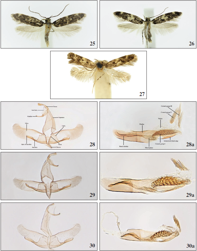 25.Apatema skulei Falck & Karsholt, sp. n., ♂, Gran Canaria, 10.5 mm. 26.Apatema skulei Falck & Karsholt, sp. n., ♀, Gran Canaria, 12 mm. 27.Apatema mediopallidum Walsingham, 1900, ♂, Holotype, Corsica, France, 12 mm. Copyright Trustes of the NHMUK. 28. Schematic illustration of male genitalia. 28a. Phallus. 29. Apatema confluellum Falck & Karsholt, sp. n., ♂, Tenerife, GP2792PF. 29a. Phallus, Tenerife, GP2796PF. 30.Apatema minimum Falck & Karsholt, sp. n., ♂, Lanzarote, GP3197PF. 30a. Phallus, Lanzarote, GP3197PF.