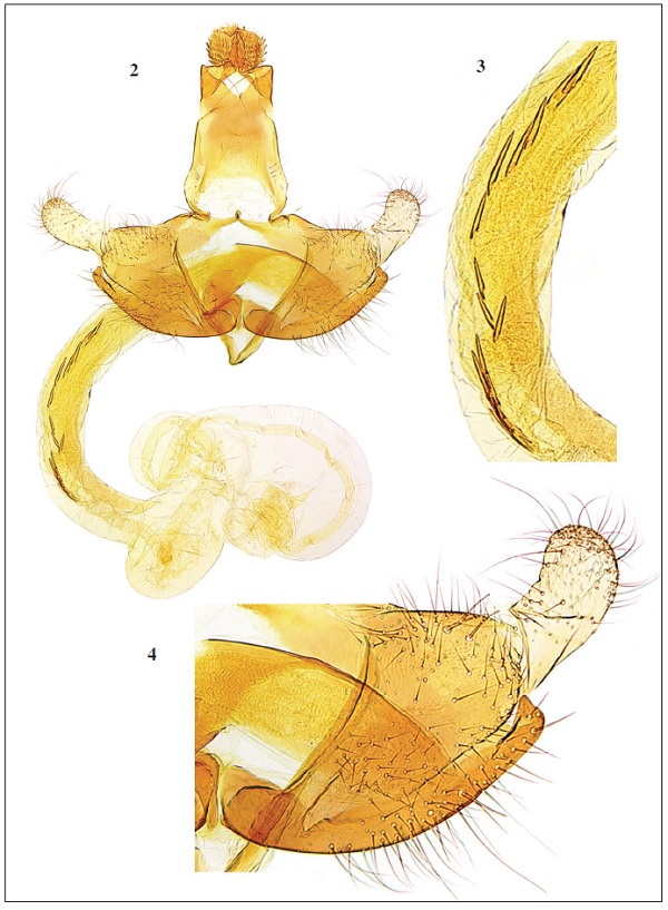 2. C. donata Baldizzone, sp. n. - male genitalia, holotype. 3. Enlargement of cornuti. 4. Enlargement of valva and phallotheca.