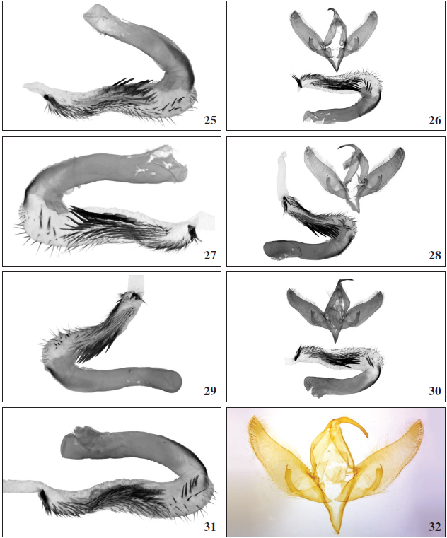 Oncocnemis michaelorum srnkai Beshkov, ssp. n. 25. paratype, everted vesica. Tchepun, 14-VIII-2020, Gen. prep. 1./28.8.2020, SB. 26. paratype, male genitalia with everted vesica. Tchepun, 14-VIII2020, Gen. prep. 1./29.8.2020, SB. 27. paratype, everted vesica. Tchepun, 14-VIII-2020, Gen. prep. 1./29.8.2020, SB. 28. paratype, male genitalia with everted vesica. Tchepun, 14-VIII-2020, Gen. prep. 2./29.8.2020, SB. 29. paratype, everted vesica. Tchepun, 14-VIII-2020, Gen. prep. 2./29.8.2020, SB. 30. paratype, male genitalia with everted vesica. Tchepun, 14-VIII-2020, Gen. prep. 2./09,9,2020, SB. 31. paratype, everted vesica. Tchepun, 14-VIII-2020, Gen. prep. 2./09.9.2020, SB. 32. Oncocnemis michaelorum michaelorum holotype, male genitalia. Balchik-Tuzlata, 10-VIII-1996, Gen. prep. 7./04.9.1996, SB.