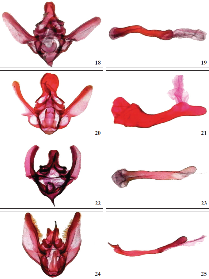 Murgisca genitalia, ventral view, phallus, lateral view. 18-19.M. taina Becker, sp. n., male paratype, Cuba. 20-21.M. subductella Becker, sp. n., male Puerto Rico. 22-23.M. antillana Becker, sp. n., male paratype, Dominican Republic. 24-25.M. cubana Becker, sp. n., male paratype, Cuba.