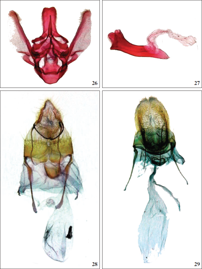 Murgisca genitalia, ventral view, phallus, lateral view. 26-27.M. sympatrica Becker, sp. n., male paratype, Cuba. 28.M. subductella (Mschler), female, Guana Id. 29.M. taina Becker, sp. n., female paratype, Cuba.
