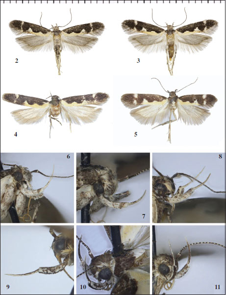 Gladiovalva spp. 2-5. Dorsal view. 2-3. 
                            G. arevika Bidzilya & Šumpich sp. n. 2. Holotype, male. 3. Paratype, female. 4-5. 
                            G. igorella Falkovitsh & Bidzilya. 4. Holotype, male. 5. Paratype, female (gen. slide 53/07, OB). 6-11. Head. 6-8. 
                            G. arevika Bidzilya & Šumpich, sp. n. 6-7. Female, Armenia. 8. Male, Iran. 9-11. 
                            G. igorella Falkovitsh & Bidzilya. 9. Holotype, male, Kazakhstan. 10-11. Paratype, female, Uzbekistan.
                        