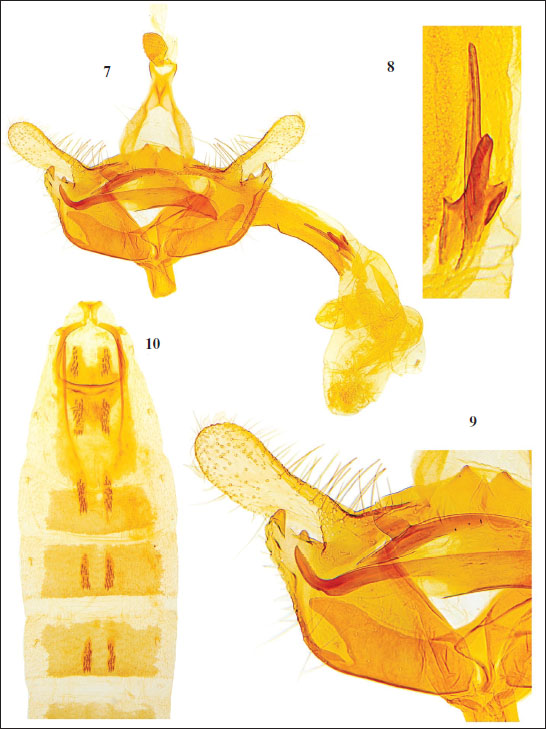7. C. turca Baldizzone, 1994 - male genitalia (PG Bldz 14205), Turkey, Anatolia, Cappadocia, dint. U&ccedil;hisar, Mustafapaşa, 1400 m, 25-VI-2005, leg. G. Bassi, in coll. Bassi. 
										8. Enlargement of cornuti. 
										9. Enlargement of valva and phallotheca. 
										10. Abdominal segments 1-5.
									